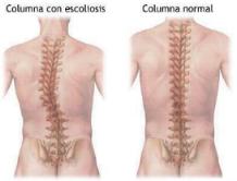 curso pilates postura